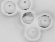 発光する種子たち [2012]