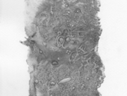 鳥の卵のあるモニュメント [2014]